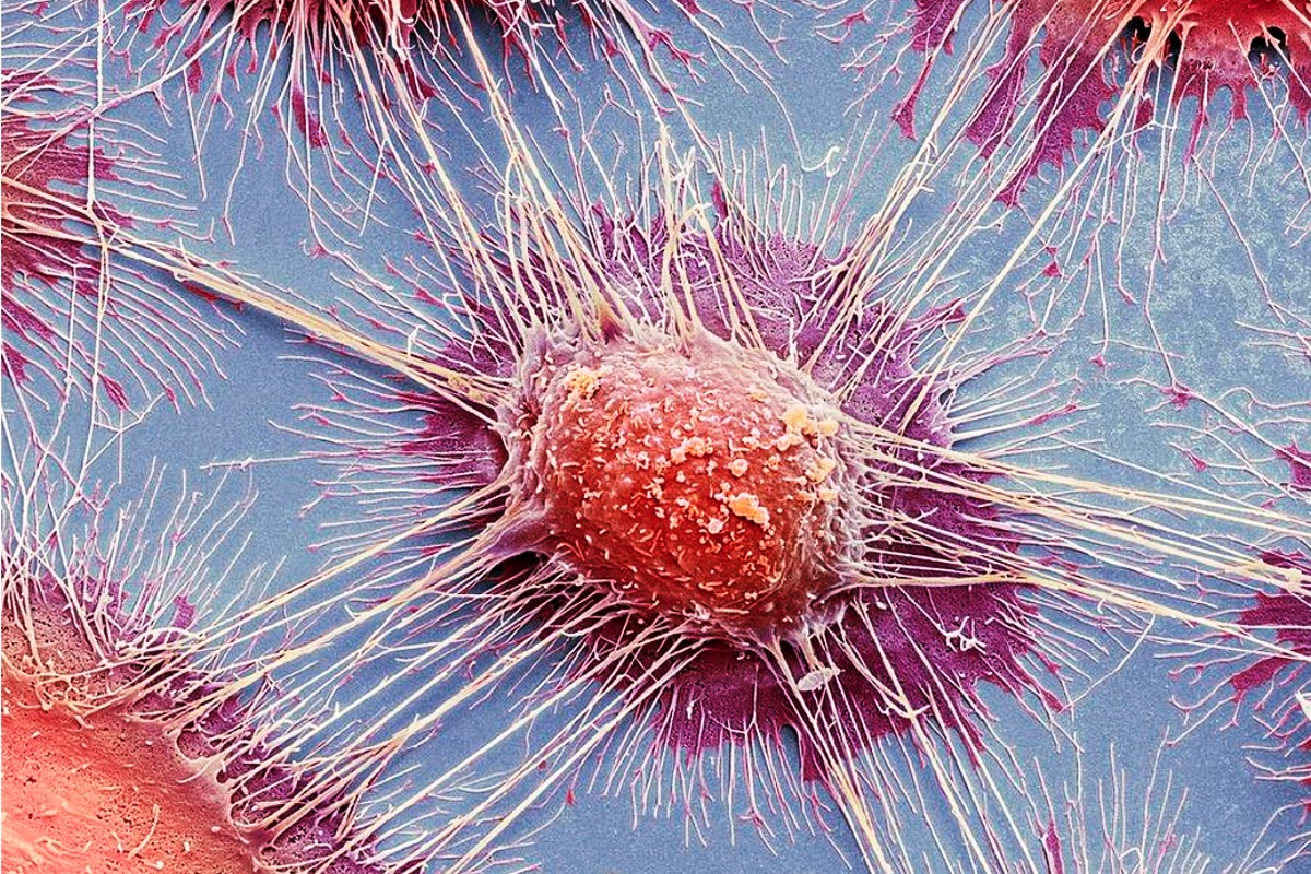 Раковые клетки через микроскоп